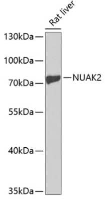 Western Blot: NUAK2 Antibody [NBP2-94277] - Analysis of extracts of rat liver, using NUAK2 at 1:1000 dilution.Secondary antibody: HRP Goat Anti-Rabbit IgG (H+L) at 1:10000 dilution.Lysates/proteins: 25ug per lane.Blocking buffer: 3% nonfat dry milk in TBST.Detection: ECL Basic Kit .Exposure time: 60s.