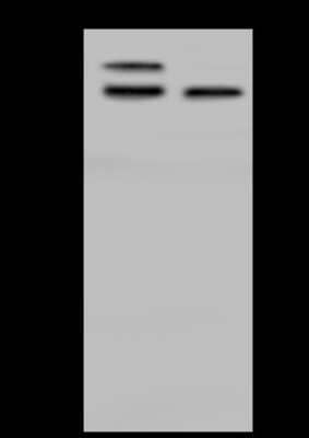 Western Blot: NUAK2 Antibody [NBP2-97857] - Anti-NUAK2 rabbit polyclonal antibody at 1:500 dilution. Lane A: RT4 Whole Cell Lysate Lane B: U-251 MG Whole Cell Lysate Lysates/proteins at 30 ug per lane. Secondary Goat Anti-Rabbit IgG (H+L)/HRP at 1/10000 dilution. Developed using the ECL technique. Performed under reducing conditions. Predicted band size: 70 kDa. Observed band size: 70 kDa (We are unsure as to the identity of these extra bands).