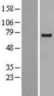 Western Blot: NUAK2 Overexpression Lysate (Adult Normal) [NBL1-13844] Left-Empty vector transfected control cell lysate (HEK293 cell lysate); Right -Over-expression Lysate for NUAK2.