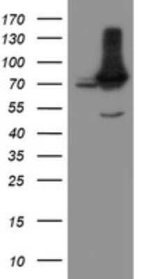 Western Blot: NUB1/NYREN18 Antibody (OTI2G1) - Azide and BSA Free [NBP2-73082] - Analysis of HEK293T cells were transfected with the pCMV6-ENTRY control (Left lane) or pCMV6-ENTRY NUB1.