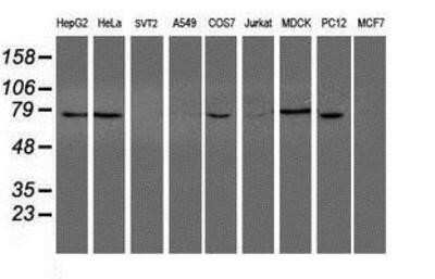Western Blot: NUB1/NYREN18 Antibody (OTI4H2) - Azide and BSA Free [NBP2-73084] - Analysis of extracts (35ug) from 9 different cell lines by using g anti-NYREN18 monoclonal antibody (HepG2: human; HeLa: human; SVT2: mouse; A549: human; COS7: monkey; Jurkat: human; MDCK: canine; PC12: rat; MCF7: human).