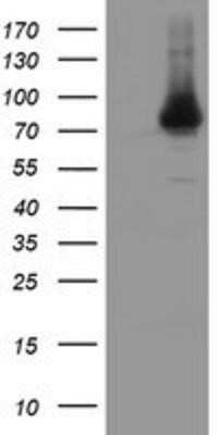 Western Blot: NUB1/NYREN18 Antibody (OTI4H2) - Azide and BSA Free [NBP2-73084] - HEK293T cells were transfected with the pCMV6-ENTRY control (Left lane) or pCMV6-ENTRY NYREN18 (Right lane) cDNA for 48 hrs and lysed. Equivalent amounts of cell lysates (5 ug per lane) were separated by SDS-PAGE and immunoblotted with anti-NYREN18.