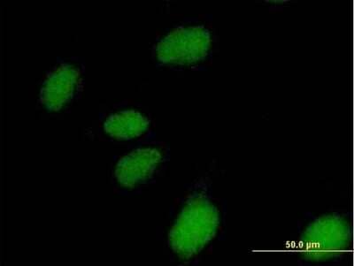 Immunocytochemistry/Immunofluorescence: NUBP1 Antibody [H00004682-B01P] - Analysis of purified antibody to NUBP1 on HeLa cell. (antibody concentration 10 ug/ml)