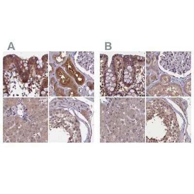 Immunohistochemistry-Paraffin: NUBP1 Antibody [NBP1-92204] - Staining of human colon, kidney, liver and testis using Anti-NUBP1 antibody NBP1-92204 (A) shows similar protein distribution across tissues to independent antibody NBP1-92205 (B).