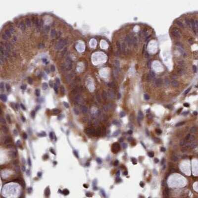 Immunohistochemistry-Paraffin: NUBP1 Antibody [NBP1-92204] - Staining of human colon.