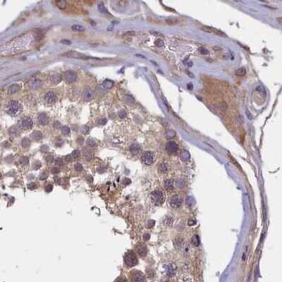 Immunohistochemistry-Paraffin: NUBP1 Antibody [NBP1-92204] - Staining of human testis.