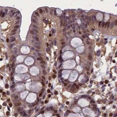 Immunohistochemistry-Paraffin: NUBP1 Antibody [NBP1-92205] - Staining of human colon.