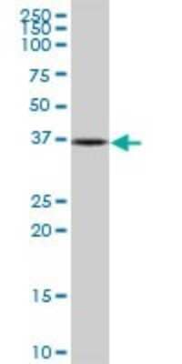 Western Blot: NUBP1 Antibody [H00004682-B01P] - Analysis of NUBP1 expression in COLO 320 HSR.