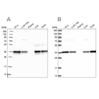 Western Blot: NUBP1 Antibody [NBP1-92205] - Analysis using Anti-NUBP1 antibody NBP1-92205 (A) shows similar pattern to independent antibody NBP1-92204 (B).