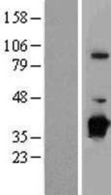 Western Blot: NUBP1 Overexpression Lysate (Adult Normal) [NBP2-08111] Left-Empty vector transfected control cell lysate (HEK293 cell lysate); Right -Over-expression Lysate for NUBP1.