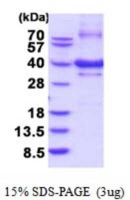 SDS-PAGE Recombinant Human NUBP1 His Protein