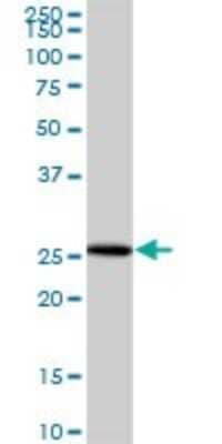 Western Blot NUBP2 Antibody - Azide and BSA Free