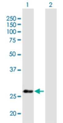 Western Blot: NUBP2 Antibody [H00010101-B01P] - Analysis of NUBP2 expression in transfected 293T cell line by NUBP2 polyclonal antibody.  Lane 1: NUBP2 transfected lysate(29.81 KDa). Lane 2: Non-transfected lysate.