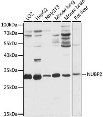 Western Blot: NUBP2 Antibody [NBP2-94547] - Analysis of extracts of various cell lines, using NUBP2 at 1:1000 dilution.Secondary antibody: HRP Goat Anti-Rabbit IgG (H+L) at 1:10000 dilution.Lysates/proteins: 25ug per lane.Blocking buffer: 3% nonfat dry milk in TBST.Detection: ECL Basic Kit .Exposure time: 5s.