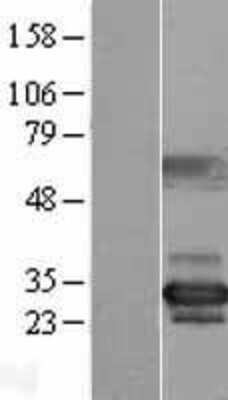 Western Blot NUBP2 Overexpression Lysate
