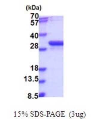 SDS-PAGE Recombinant Human NUBP2 His Protein