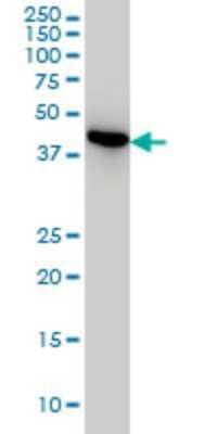 Western Blot: NUDC Antibody (5G12) [H00010726-M01] - NUDC monoclonal antibody (M01), clone 5G12 Analysis of NUDC expression in HeLa.