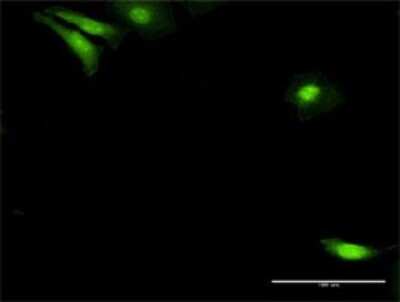 Immunocytochemistry/Immunofluorescence: NUDC Antibody [H00010726-D01P] - Analysis of antibody to NUDC on HeLa cell. Antibody concentration 20 ug/ml.