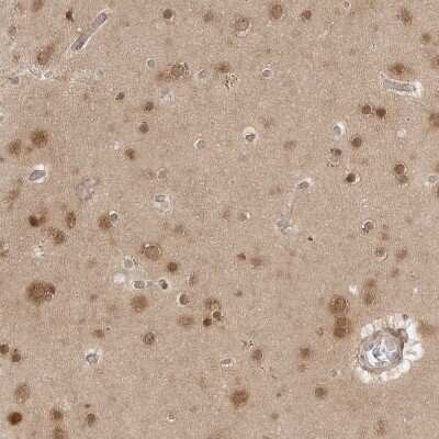Immunohistochemistry-Paraffin: NUDC Antibody [NBP1-89510] - Staining of human cerebral cortex shows weak to moderate cytoplasmic and nuclear positivity in neurons.