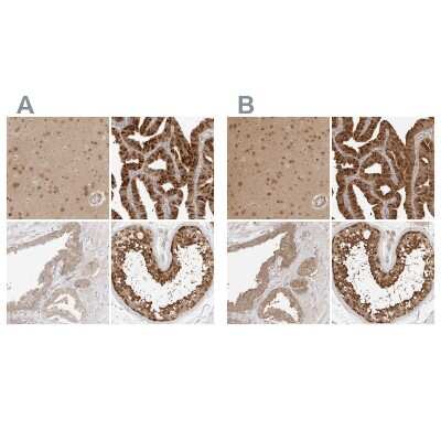 <b>Independent Antibodies Validation. </b>Immunohistochemistry-Paraffin: NUDC Antibody [NBP1-89510] - Staining of human cerebral cortex, fallopian tube, prostate and testis using Anti-NUDC antibody NBP1-89510 (A) shows similar protein distribution across tissues to independent antibody NBP1-89517 (B).