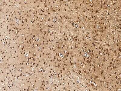Immunohistochemistry-Paraffin: NUDC Antibody [NBP2-96997] - Staining of human NUDC in human brain with rabbit polyclonal antibody (1:5000).