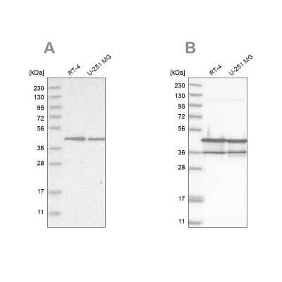 <b>Independent Antibodies Validation. </b>Western Blot: NUDC Antibody [NBP1-89510] - Analysis using Anti-NUDC antibody NBP1-89510 (A) shows similar pattern to independent antibody NBP1-89517 (B).