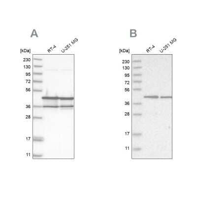 Western Blot: NUDC Antibody [NBP1-89517] - Analysis using Anti-NUDC antibody NBP1-89517 (A) shows similar pattern to independent antibody NBP1-89510 (B).