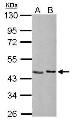 Western Blot: NUDC Antibody [NBP2-19604] - Sample (30 ug of whole cell lysate) A: NIH-3T3 B: BCL-1 10% SDS PAGE gel, diluted at 1:1000.