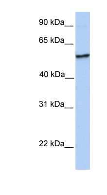 Western Blot: NUDCD1 Antibody [NBP1-55000] - Human Placenta lysate, concentration 0.2-1 ug/ml.