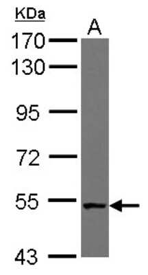 Western Blot: NUDCD1 Antibody [NBP2-19605] - Sample (30 ug of whole cell lysate) A: NT2D1 7. 5% SDS PAGE gel, diluted at 1:10000.