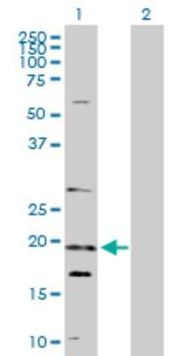 Western Blot: NUDT10 Antibody [H00170685-D01P] - Analysis of NUDT10 expression in transfected 293T cell line by NUDT10 polyclonal antibody.Lane 1: NUDT10 transfected lysate(18.50 KDa).Lane 2: Non-transfected lysate.