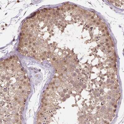 Immunohistochemistry NUDT11 Antibody