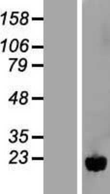 Western Blot NUDT11 Overexpression Lysate