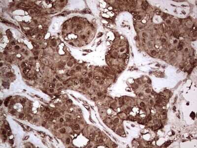 Immunohistochemistry NUDT12 Antibody (OTI2G2)