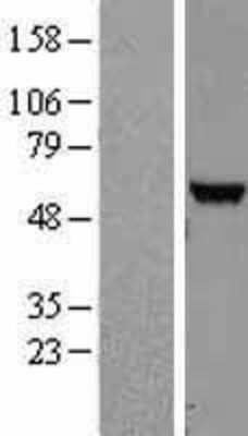 Western Blot: NUDT12 Overexpression Lysate (Adult Normal) [NBL1-13855] Left-Empty vector transfected control cell lysate (HEK293 cell lysate); Right -Over-expression Lysate for NUDT12.