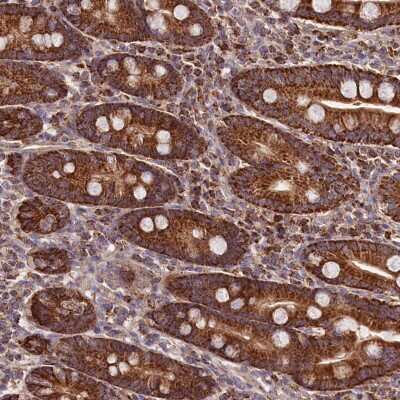 Immunohistochemistry: NUDT15 Antibody [NBP2-38436] - Staining of human duodenum shows strong cytoplasmic positivity in glandular cells.