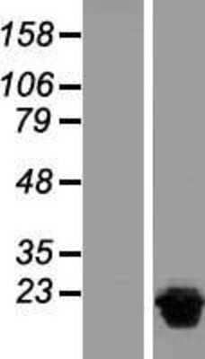 Western Blot: NUDT15 Overexpression Lysate (Adult Normal) [NBL1-13856] Left-Empty vector transfected control cell lysate (HEK293 cell lysate); Right -Over-expression Lysate for NUDT15.