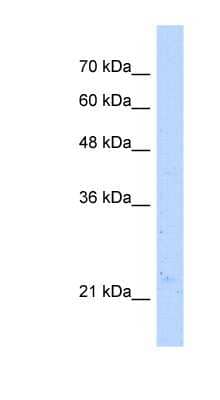 Western Blot: NUDT16L1 Antibody [NBP1-55432] - HepG2 cell lysate, concentration 5.0ug/ml.