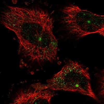 Immunocytochemistry/Immunofluorescence: NUDT17 Antibody [NBP1-93842] - Immunofluorescent staining of human cell line U-251 MG shows localization to centrosome.