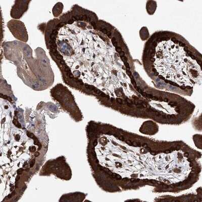 Immunohistochemistry-Paraffin: NUDT17 Antibody [NBP1-93842] - Staining of human placenta shows strong cytoplasmic positivity in trophoblastic cells.