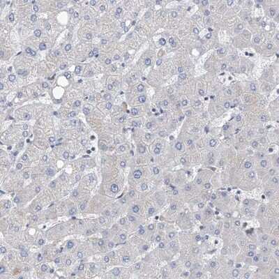 Immunohistochemistry-Paraffin: NUDT17 Antibody [NBP1-93842] - Staining of human liver shows low expression as expected.