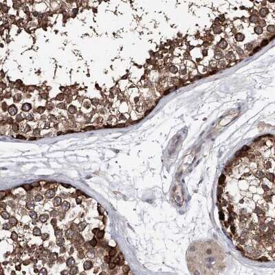 Immunohistochemistry-Paraffin: NUDT17 Antibody [NBP1-93842] - Staining of human testis shows high expression.