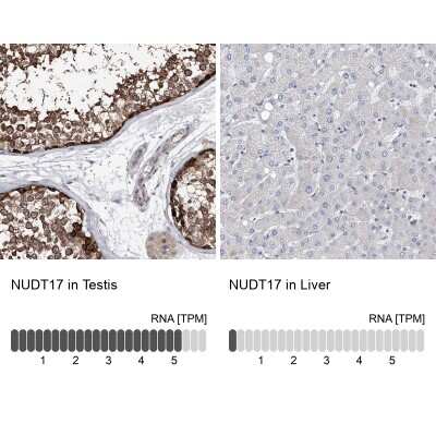 Immunohistochemistry-Paraffin: NUDT17 Antibody [NBP1-93842] - Staining in human testis and liver tissues using anti-NUDT17 antibody. Corresponding NUDT17 RNA-seq data are presented for the same tissues.