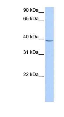 Western Blot NUDT17 Antibody - BSA Free