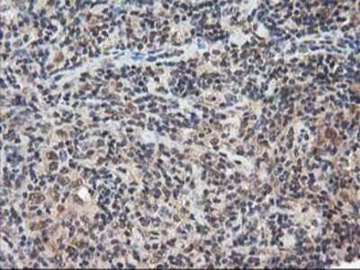 Immunohistochemistry-Paraffin: NUDT18 Antibody (5D7) [NBP2-01432] - Staining of paraffin-embedded Human lymphoma tissue using anti-NUDT18 mouse monoclonal antibody.