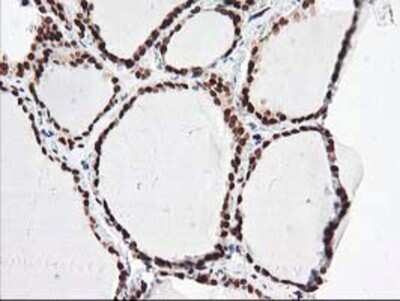 Immunohistochemistry-Paraffin: NUDT18 Antibody (5D7) [NBP2-01432] - Staining of paraffin-embedded Human thyroid tissue using anti-NUDT18 mouse monoclonal antibody.