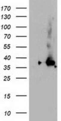 Western Blot: NUDT18 Antibody (5D7) [NBP2-01432] - HEK293T cells were transfected with the pCMV6-ENTRY control (Left lane) or pCMV6-ENTRY NUDT18 (Right lane) cDNA for 48 hrs and lysed. Equivalent amounts of cell lysates (5 ug per lane) were separated by SDS-PAGE and immunoblotted with anti-NUDT18.