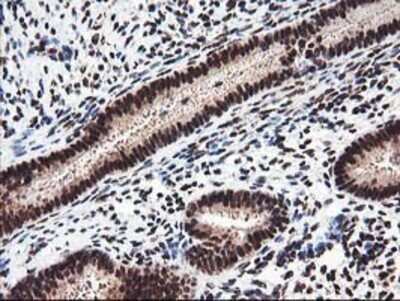 Immunohistochemistry: NUDT18 Antibody (OTI5D7) - Azide and BSA Free [NBP2-73110] - Staining of paraffin-embedded Human endometrium tissue using anti-NUDT18 mouse monoclonal antibody.