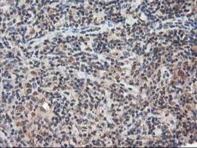 Immunohistochemistry: NUDT18 Antibody (OTI5D7) - Azide and BSA Free [NBP2-73110] - Staining of paraffin-embedded Human lymphoma tissue using anti-NUDT18 mouse monoclonal antibody.