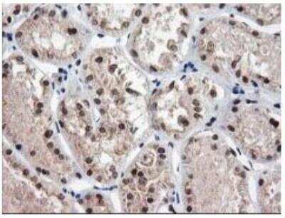 Immunohistochemistry-Paraffin NUDT18 Antibody (OTI5D7)